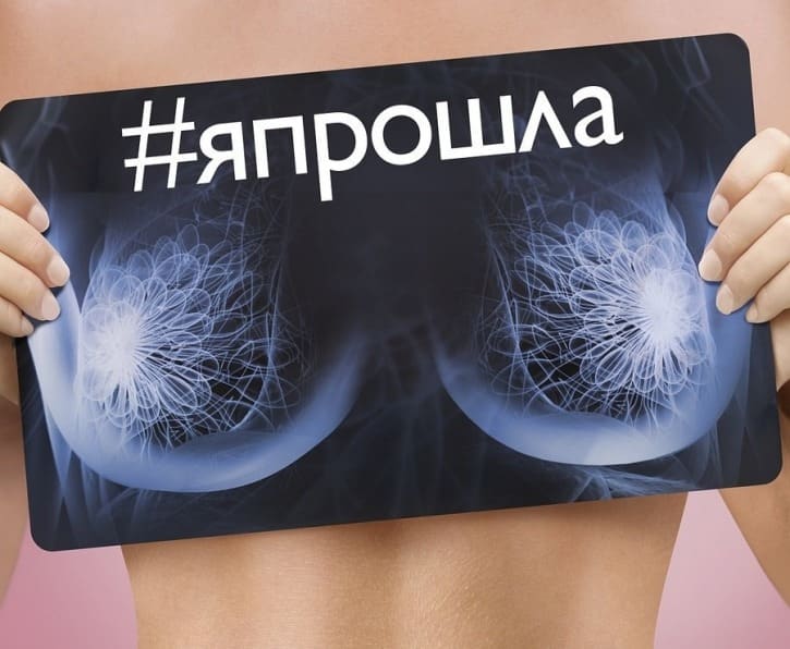 Акция по профилактике рака груди состоится в Казани