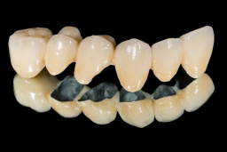 Зубы как новые: всё о восстановлении с помощью металлокерамики
